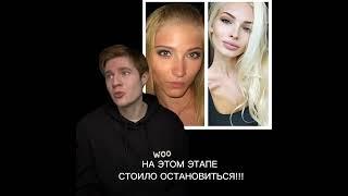 Что с лицом Алёны Шишковой