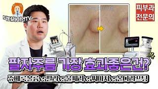 팔자주름 가장 효과좋은건 쥬베룩볼륨vs필러vs울쎄라vs써마지vs온다리프팅 ⭐비교분석⭐