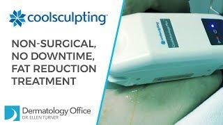 CoolSculpting for Non-Surgical Fat Reduction