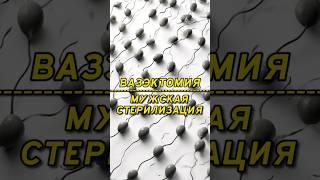Вазэктомия или мужская стерилизация #доктор #врач #уролог#каримов #вазэктомия #мужская #стерилизация