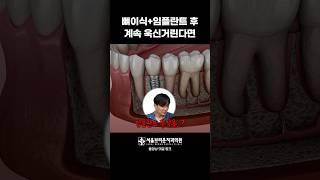 임플란트 뼈이식 시술 후 통증이 계속된다면?