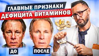 Внешние проявления недостатка витаминов. Витамины A, C, B, D, E, K