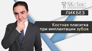 Костная пластика при имплантации зубов  | Блог #7 | NKClinic