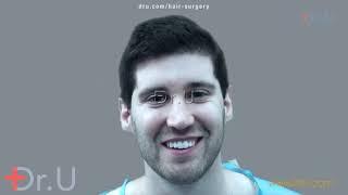 Hair Restoration Real Patient Testimonials