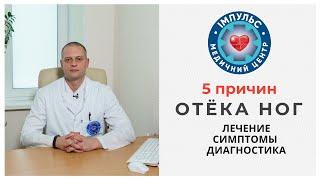 5 причин отёка ног - что делать и как лечить