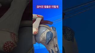 끊어진 힘줄은 이렇게 붙입니다 [날아라정형외과 관절수술센터]