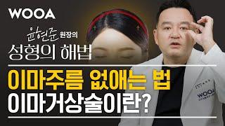 [성형의 해법] 이마주름 없애는 법,  이마거상술이란 | 이마거상술