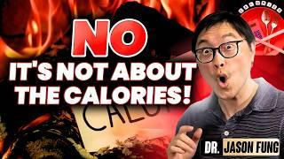 Cutting Calories Doesn't Work - It's simple Algebra  || Jason Fung