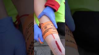 Stop the Bleed with a special rubber band🩸 #ambulance #paramedic  #emergency #hospital #firstaid
