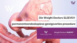 Die Weight Doctors Sleeve: permanente endoskopiese gewigsverlies prosedure