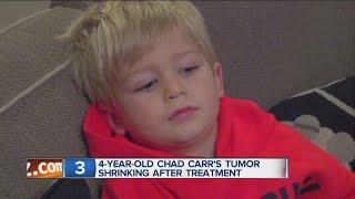4-year-old Chad Carr's tumor shrinking after treatment