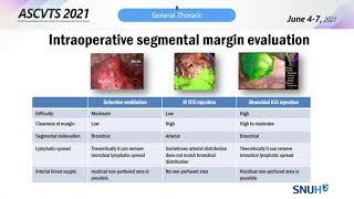 Technical issues in VATS segmentectomy