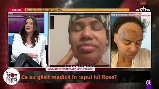 Ce au descoperit medicii la malformația lui Adhiambo Rose