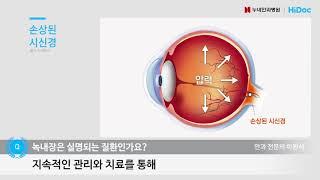 녹내장은 실명되는 질환인가요 / 누네안과병원 녹내장센터 이원석 원장