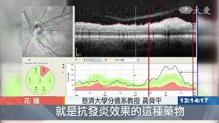 視神經治療新發現 慈大團隊獲專利