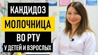 Молочница во рту: причины, симптомы и лечение. Как лечить кандидоз полости рта