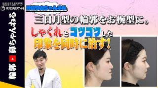 【骨切り山ちゃんネル】しゃくれを治したいあなたへ〜印象をガラッと変えます〜