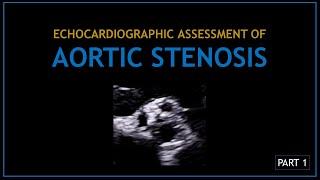 AORTIC STENOSIS (Echocardiographic assessment) - PART 1