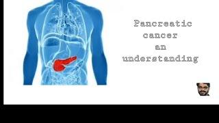 #cancer #pancreaticcancer #understanding of pancreatic cancer