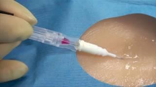 Arrow® Arterial QuickFlash