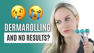 Not Seeing Results After Dermarolling? You Should WATCH THIS.