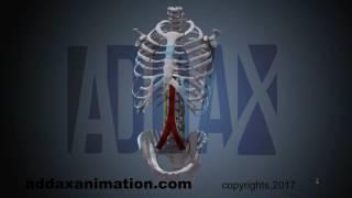 Endoscopic Lumbar Sympathectomy (ELS) animation surgery