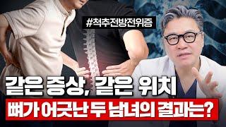 같은 증상, 같은 위치! 뼈가 어긋난 두 남녀의 결과는? #척추전방전위증 | 참포도나무병원 이동엽 원장