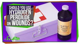 Should You Use Hydrogen Peroxide to Clean Wounds?