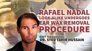 Raffael Nadal’s Look alike Regains Hearing After Removal of Longstanding Impacted Ear Wax