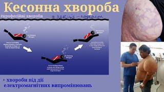 Кесонна хвороба ( Декомпресійна хвороба) | Хвороби зумовлені дією електромагнітного випромінювання