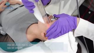 Trị Nám, Tàn Nhang Tại Viện Thẩm Mỹ Daimec Hải Phòng có gì HOT????