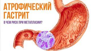 Атрофический гастрит и метаплазия в желудке: прекратить игнорировать, защитить слизистую желудка!