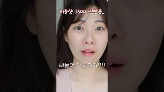 리들샷 1300..?이 고통이 맞는건가요?효과,사용법,후기까지‼️