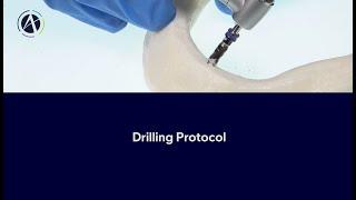 Adin Guidance | How to use - Drilling Protocol