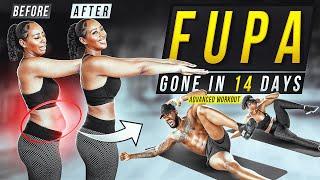 FUPA BE GONE IN 14 DAYS | Ab Challenge (ADVANCED Workout)