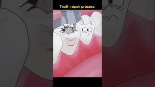 tooth repair process