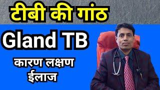 Gland TB Treatment // Lymph Node TB // Symptoms of #GlandTB // Diagnosis  // DrSanjayChestSpecialist