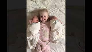 Twins!!   Revealed To Family At Birth