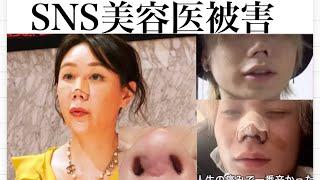 【鼻整形感染】銀座な◯えママさん、肋軟骨の鼻中隔延長をした結果SNS美容外科医の餌食に。。。