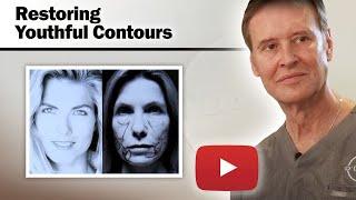 Female Facelift - Restoring Youthful Contours Through Surgical Techniques - Dr. O'Daniel