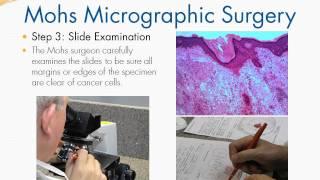 Mohs Micrographic Surgery Day