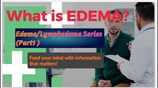 What is Edema ? A Detailed Medical Definition