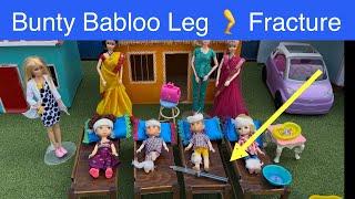 Barbie doll videos Tamil - Episode 8 | Bunty Babloo Leg  Fracture #barbie #chintu #bunty