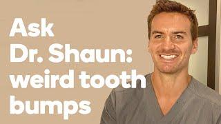 Ask Dr. Shaun: What are these bumps on my teeth?