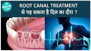 Root Canal Treatment से है Heart Attack का खतरा ? | Health Live