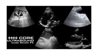 Core Ultrasound Image Review, Episode 5