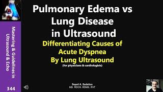 Pulmonary Edema vs Lung Disease in US: Differentiating Causes of Acute Dyspnea By Lung Ultrasound