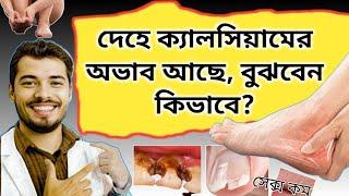 ক্যালসিয়ামের অভাবজনিত ১০ টি লক্ষণ | Common Signs and Symptoms of Calcium Deficiency