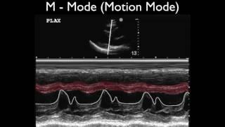 Ultrasound Physics Scanning Modes M Mode