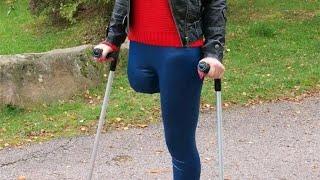 The beautiful amputee woman challenges disability with an artificial leg #amputee